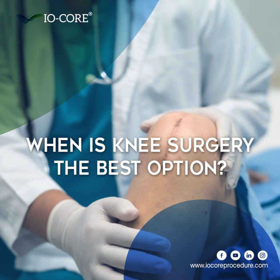 When Is Knee Surgery The Best Option IO Core