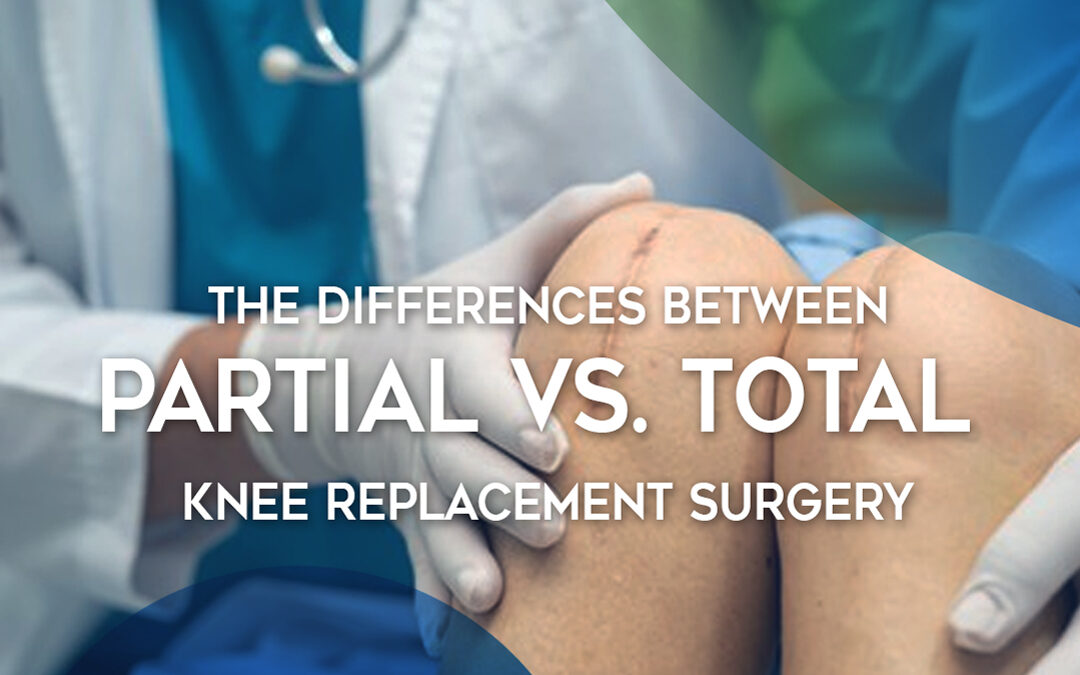 The Differences Between Partial Vs. Total Knee Replacement