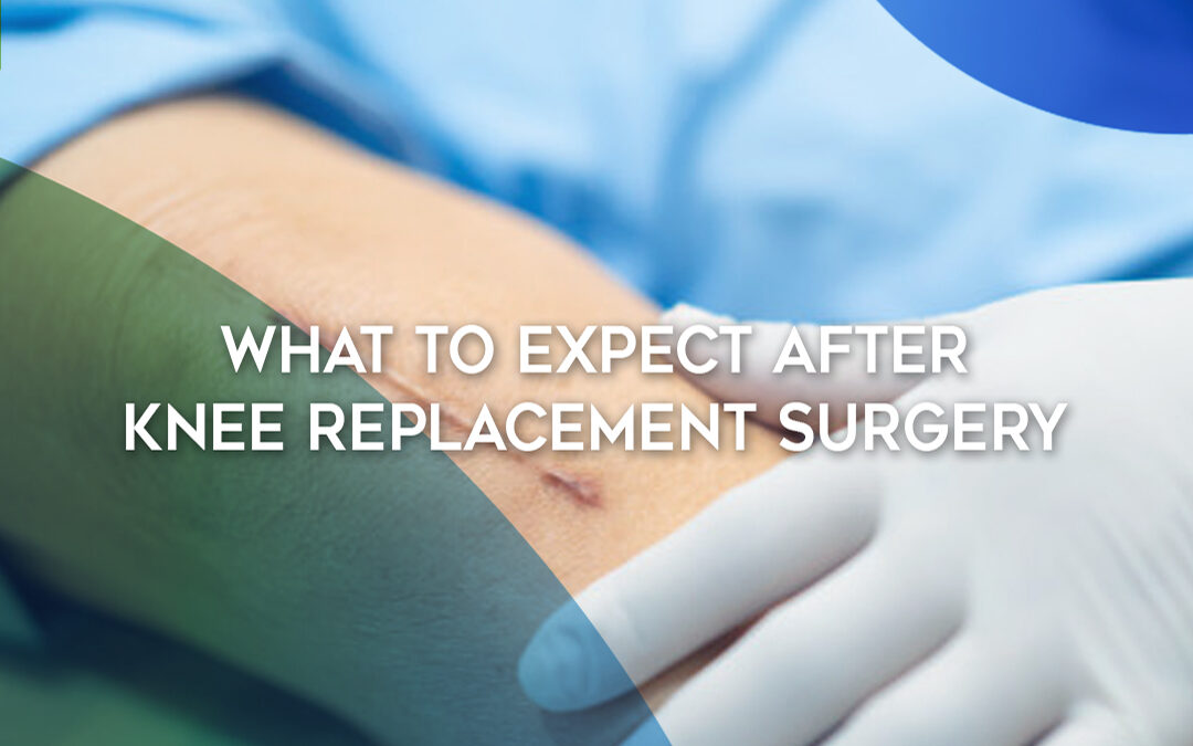What to Expect During Knee Replacement Surgery