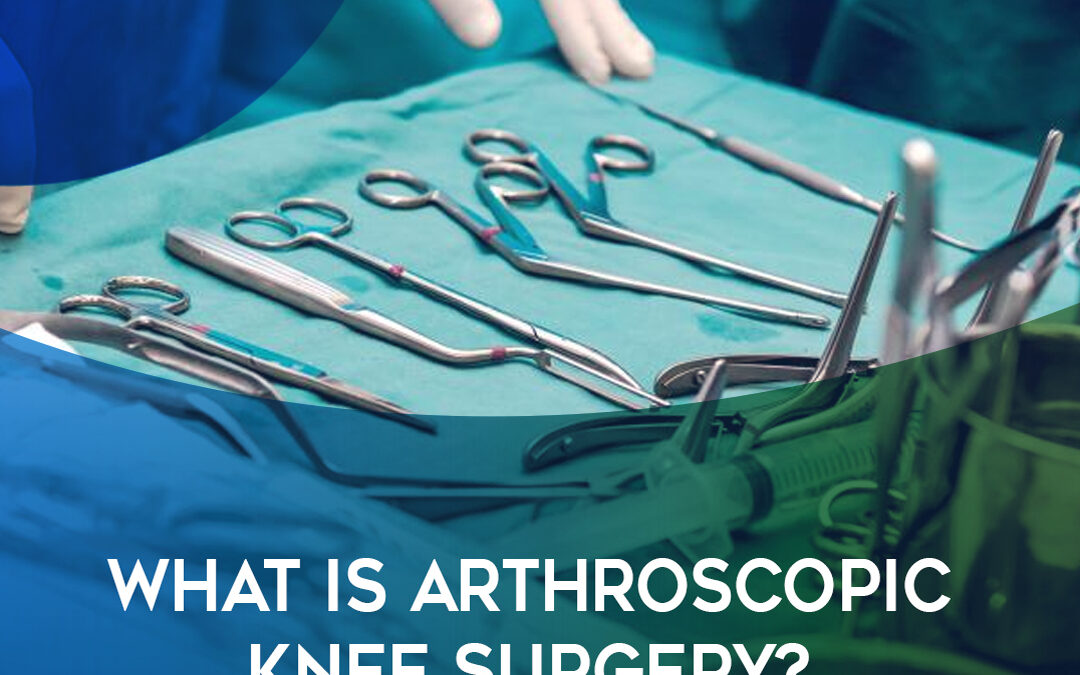 What Is Arthroscopic Knee Surgery?