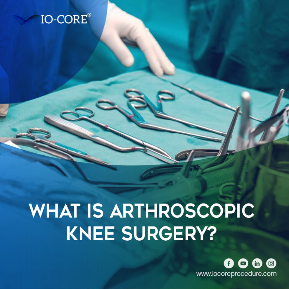 What Is Arthroscopic Knee Surgery? iOCore