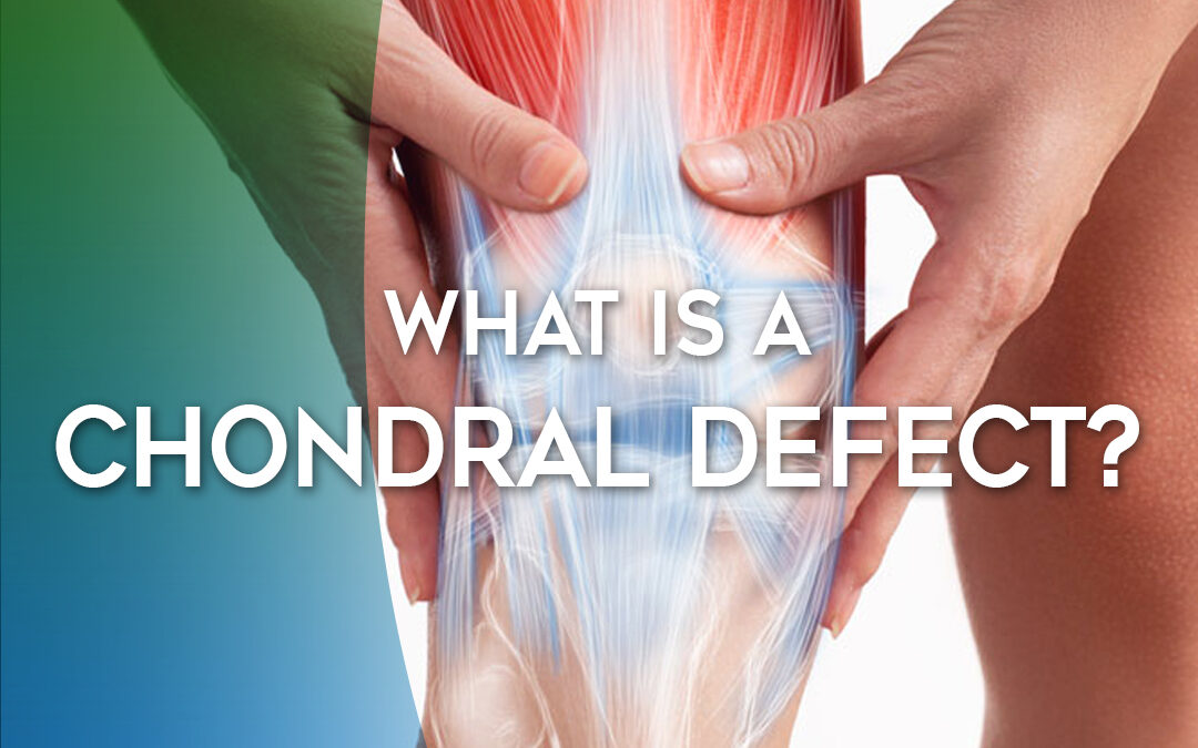 What Is a Chondral Defect?