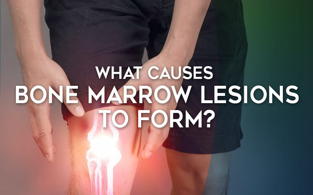 What Causes Bone Marrow Lesions to Form?