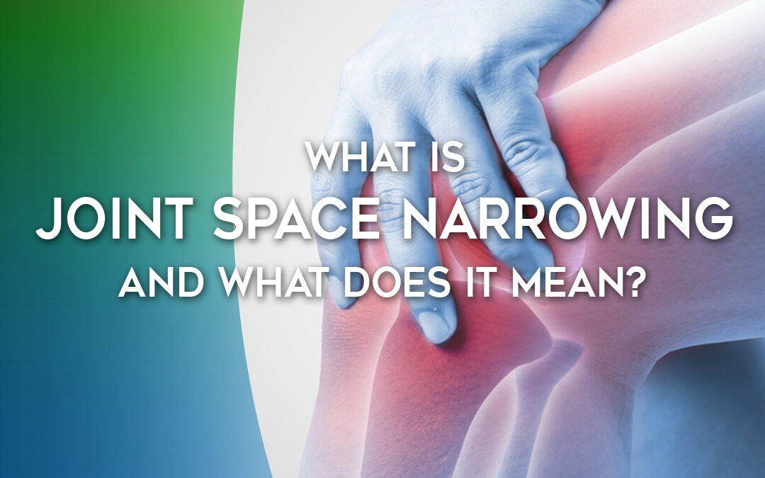 What Is Joint Space Narrowing and What Does It Mean?