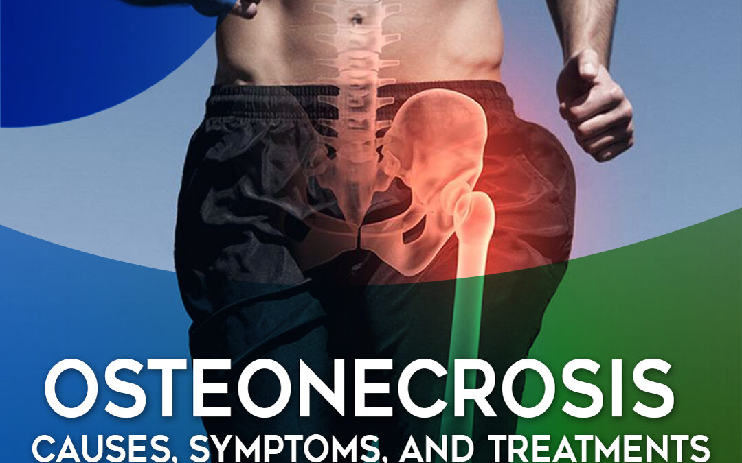 Osteonecrosis: Causes, Symptoms, and Treatments